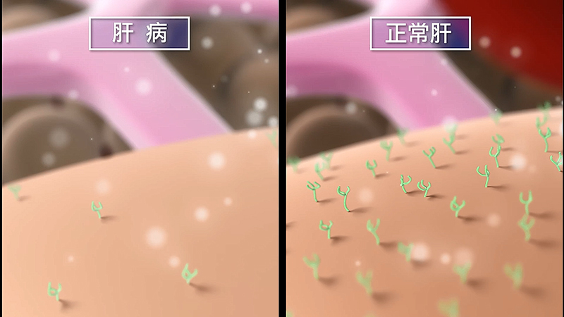 肝臟實質細胞細胞膜表面的去唾液酸醣蛋白受體數量，在正常肝臟和肝病肝臟有差異