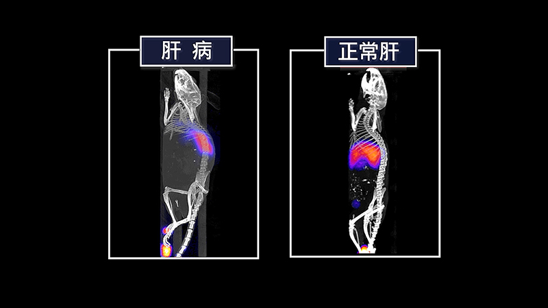 透過去唾液酸醣蛋白受體造影術，可靈敏看出正常肝與肝病的造影差別