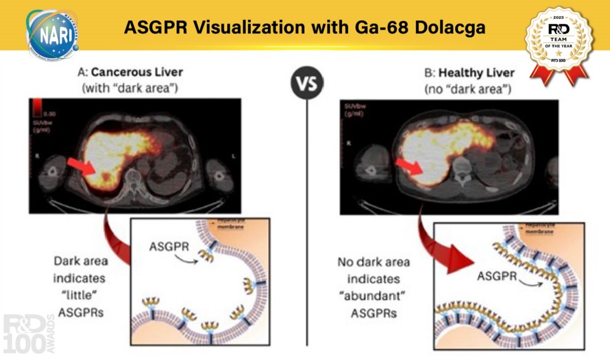 技術特色1 以Ga-68 Dolacga進行ASGPR影像化