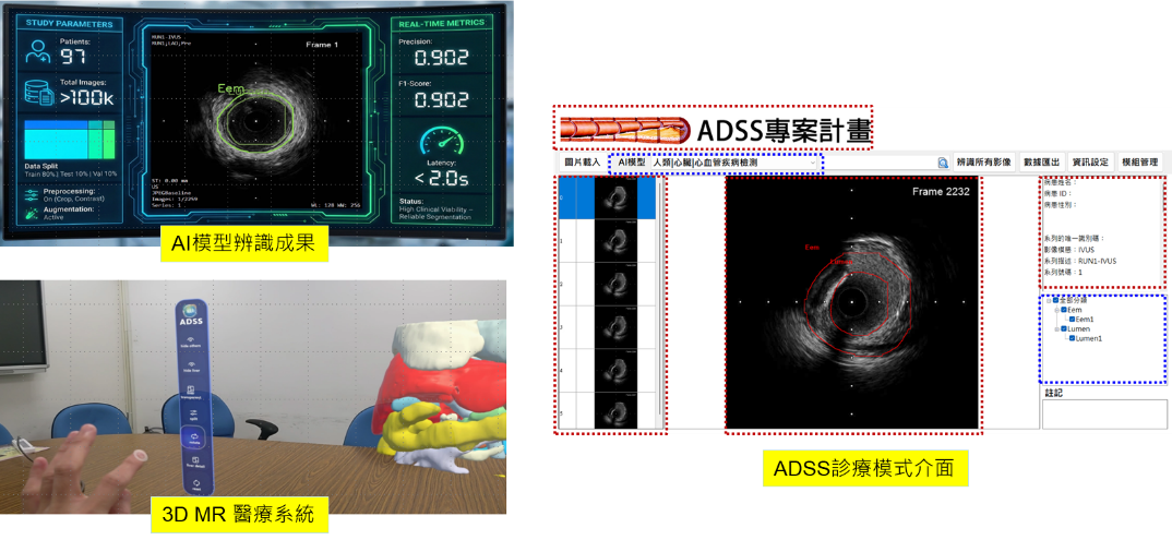 醫療AI辨識、輔助診療介面及3D MR呈現